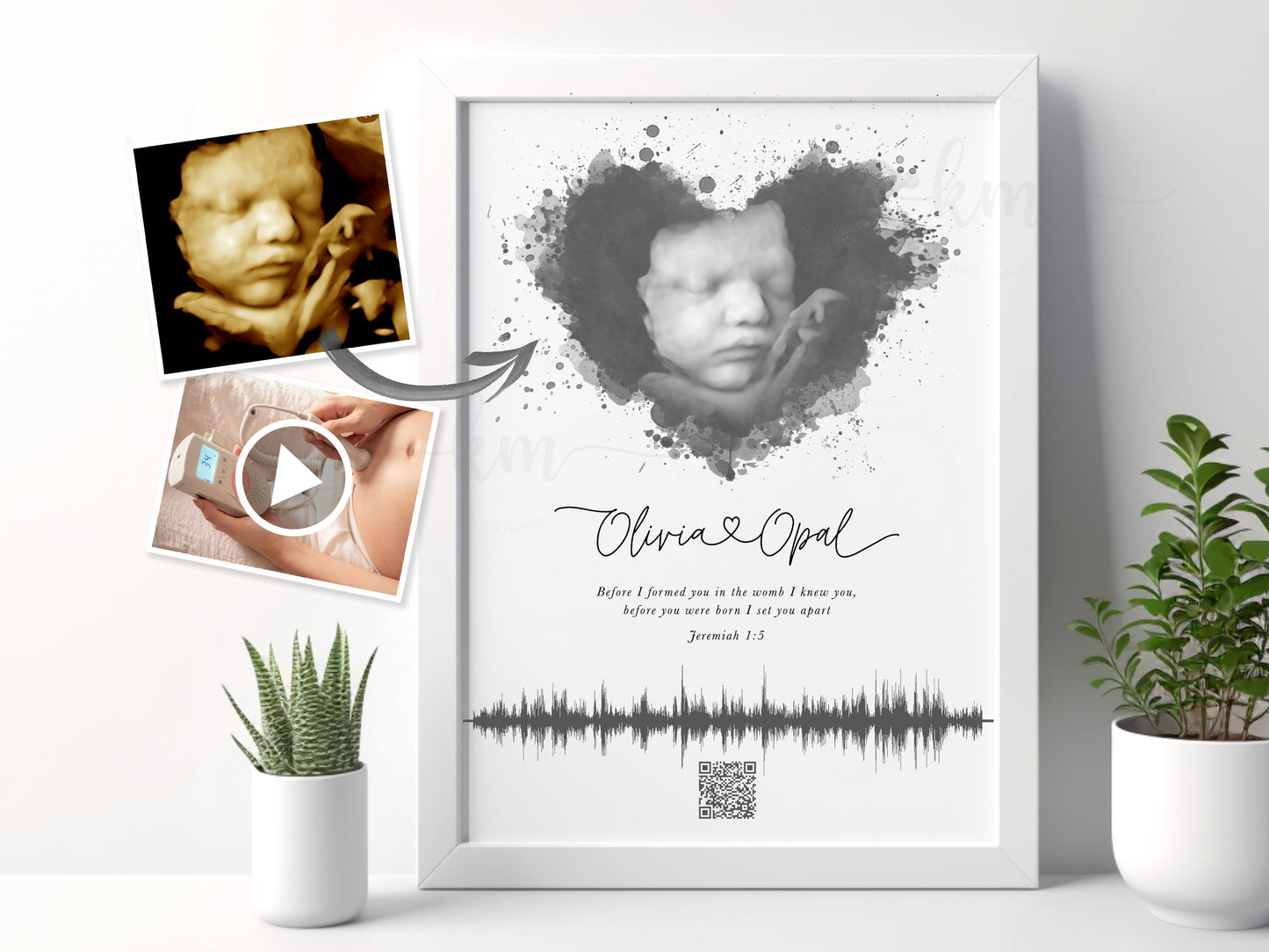 Custom watercolor ultrasound art with heartbeat soundwave and QR code

