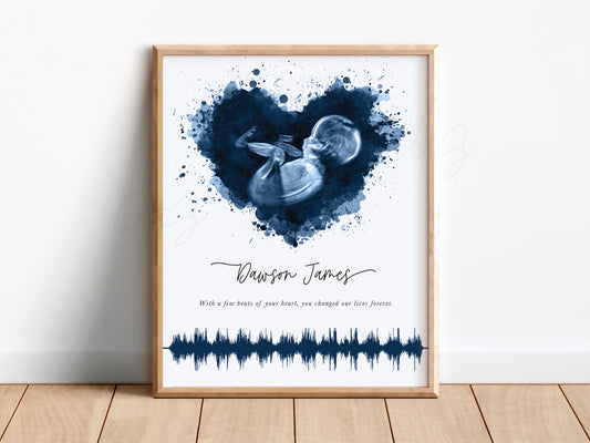 Splatter Heart Ultrasound Art with Baby Heartbeat