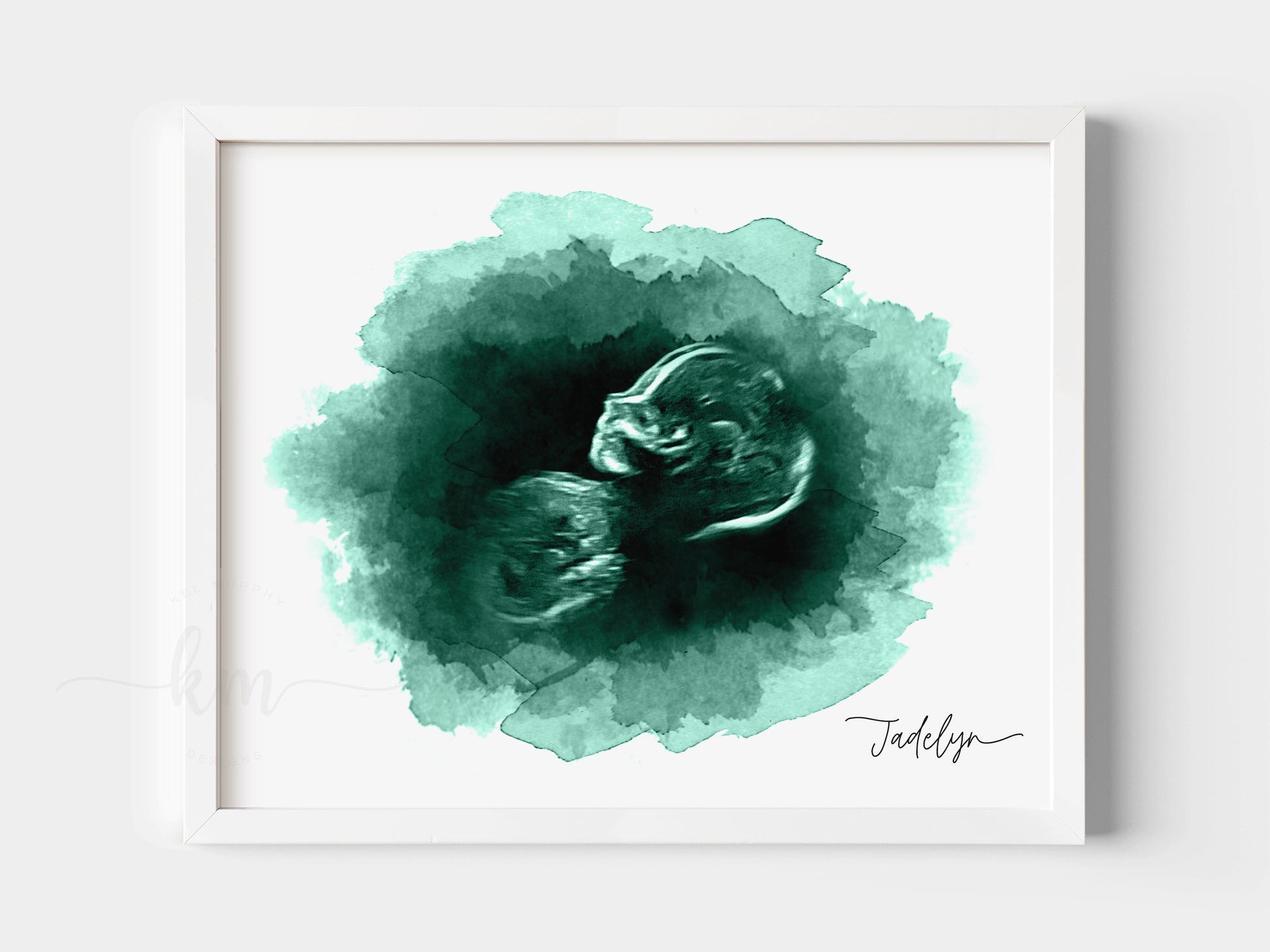 Custom ultrasound artwork with oval watercolor design

