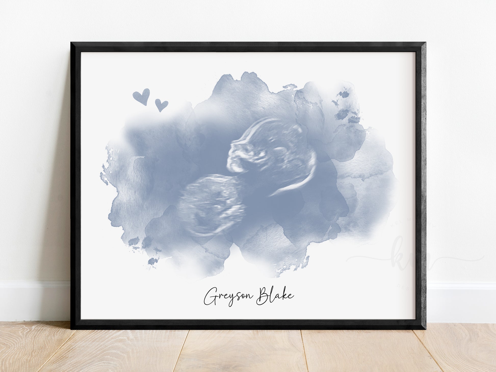 Personalized ultrasound memorial art with heart and cloud design

