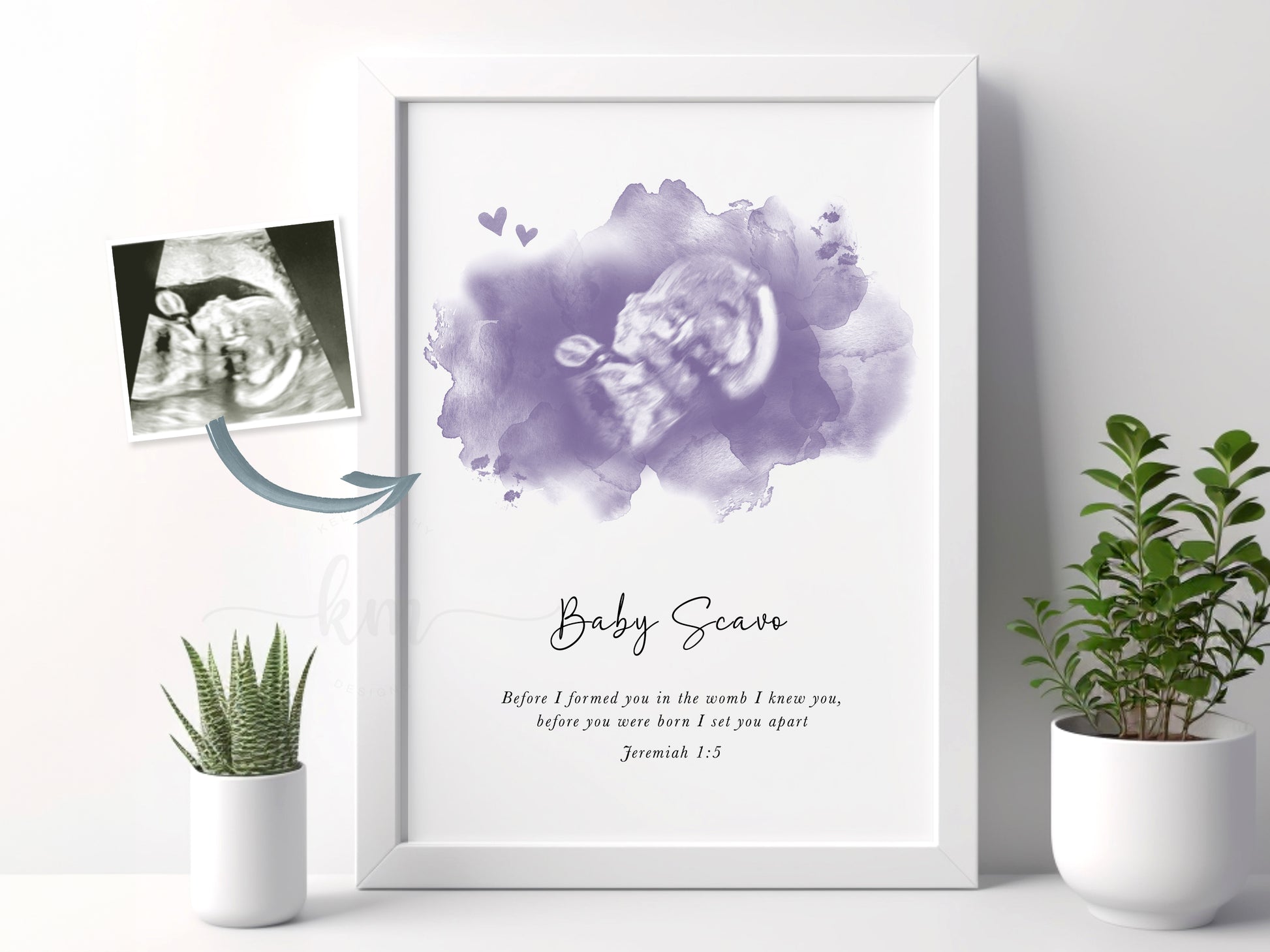 Watercolor baby loss keepsake featuring sonogram and heart accents

