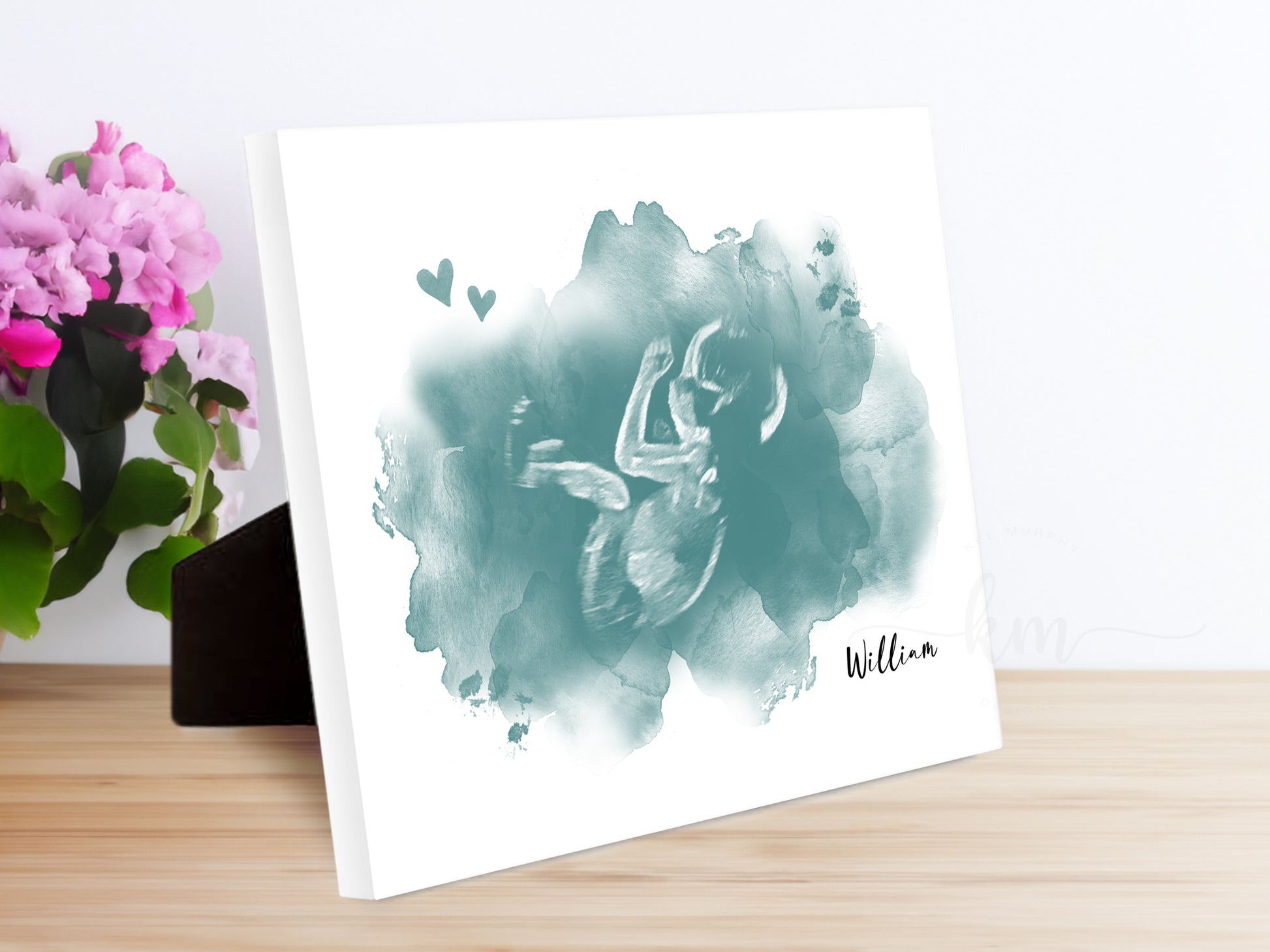 Memorial ultrasound artwork for miscarriage or baby remembrance

