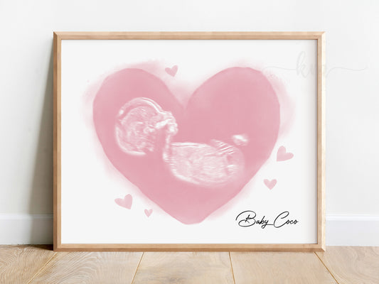 Watercolor ultrasound art with heart design – custom baby loss or baby shower gift

