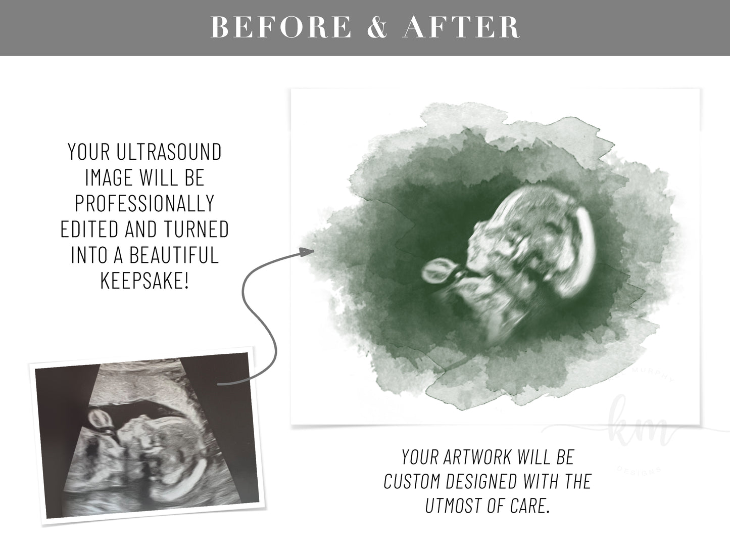Custom watercolor oval ultrasound art for pregnancy loss memorial gift

