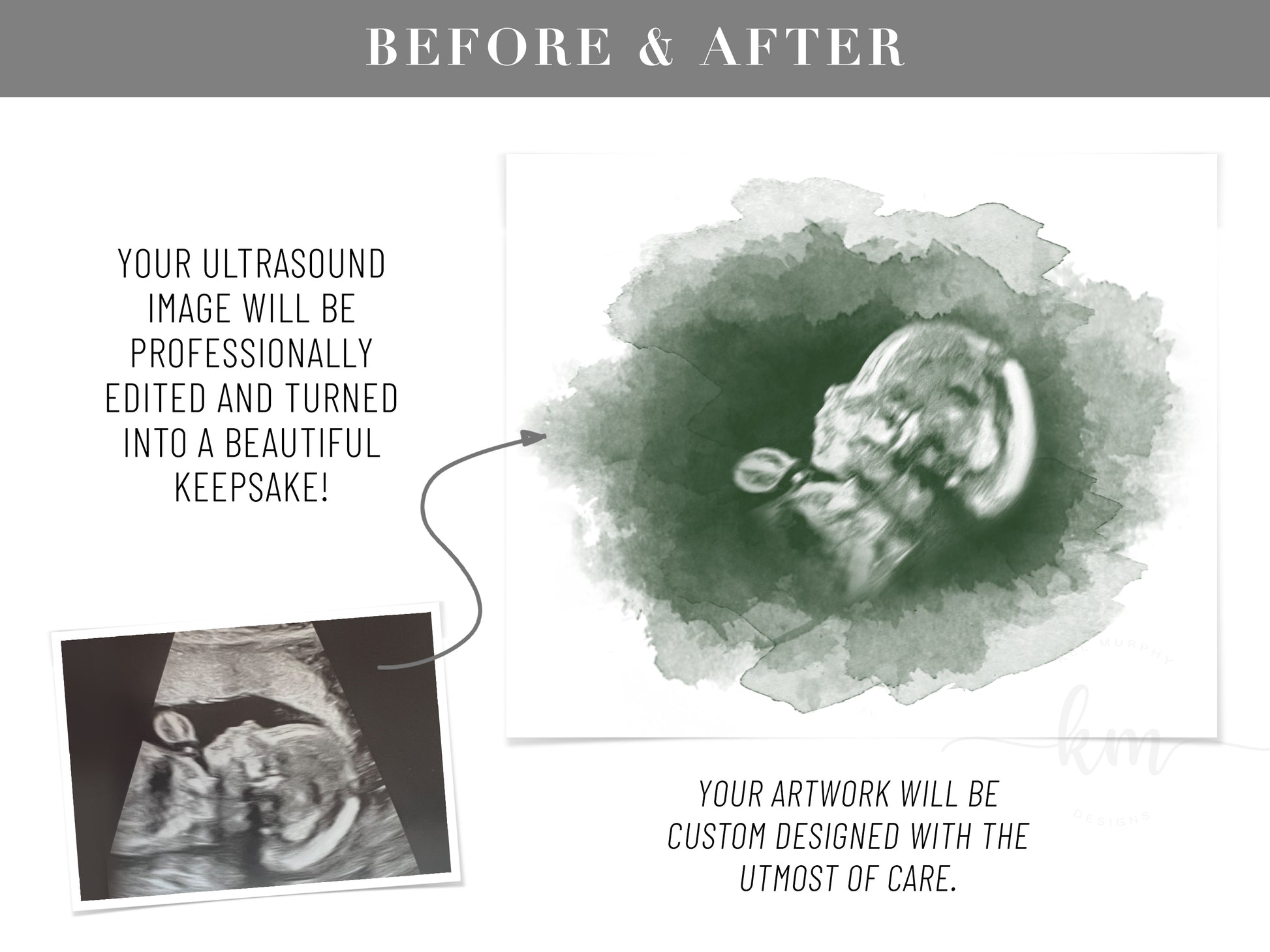 Custom watercolor oval ultrasound art for pregnancy loss memorial gift

