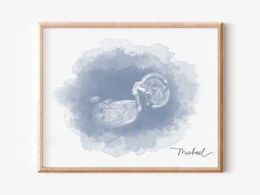 Oval watercolor ultrasound art for baby loss or baby shower gift


