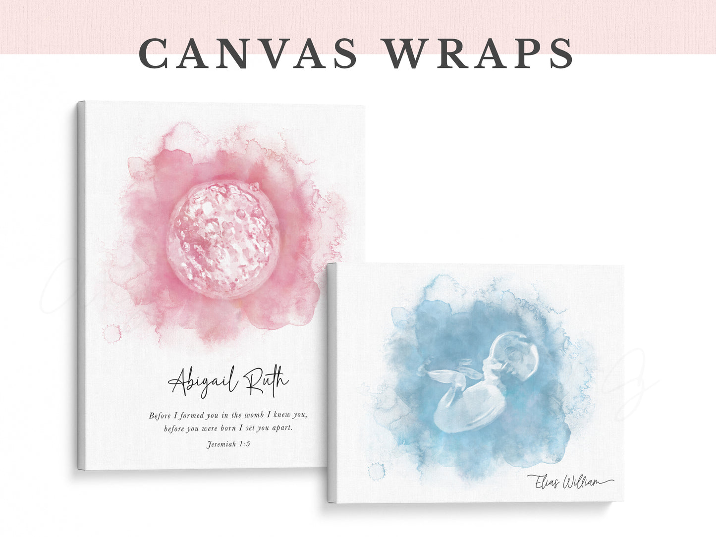 Circle Watercolor Ultrasound Art