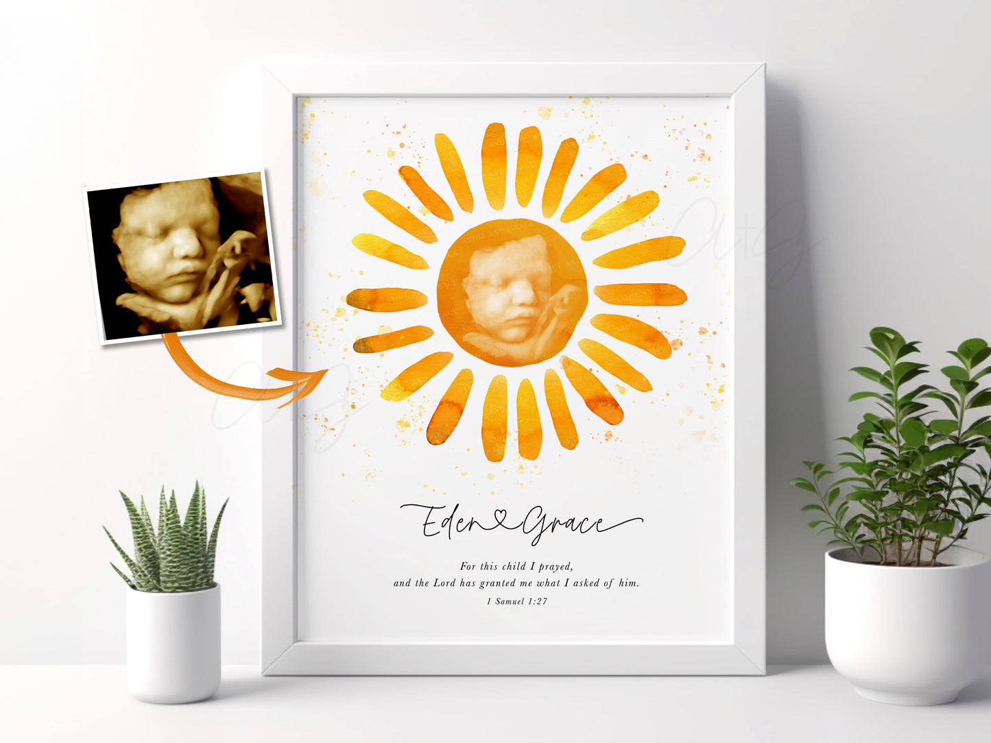 Sun Watercolor Ultrasound Art
