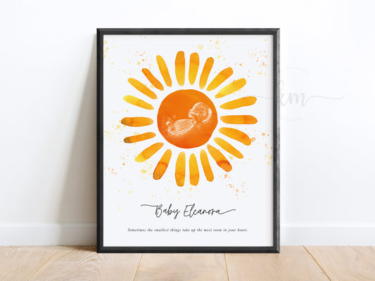 You Are My Sunshine Watercolor Ultrasound Art