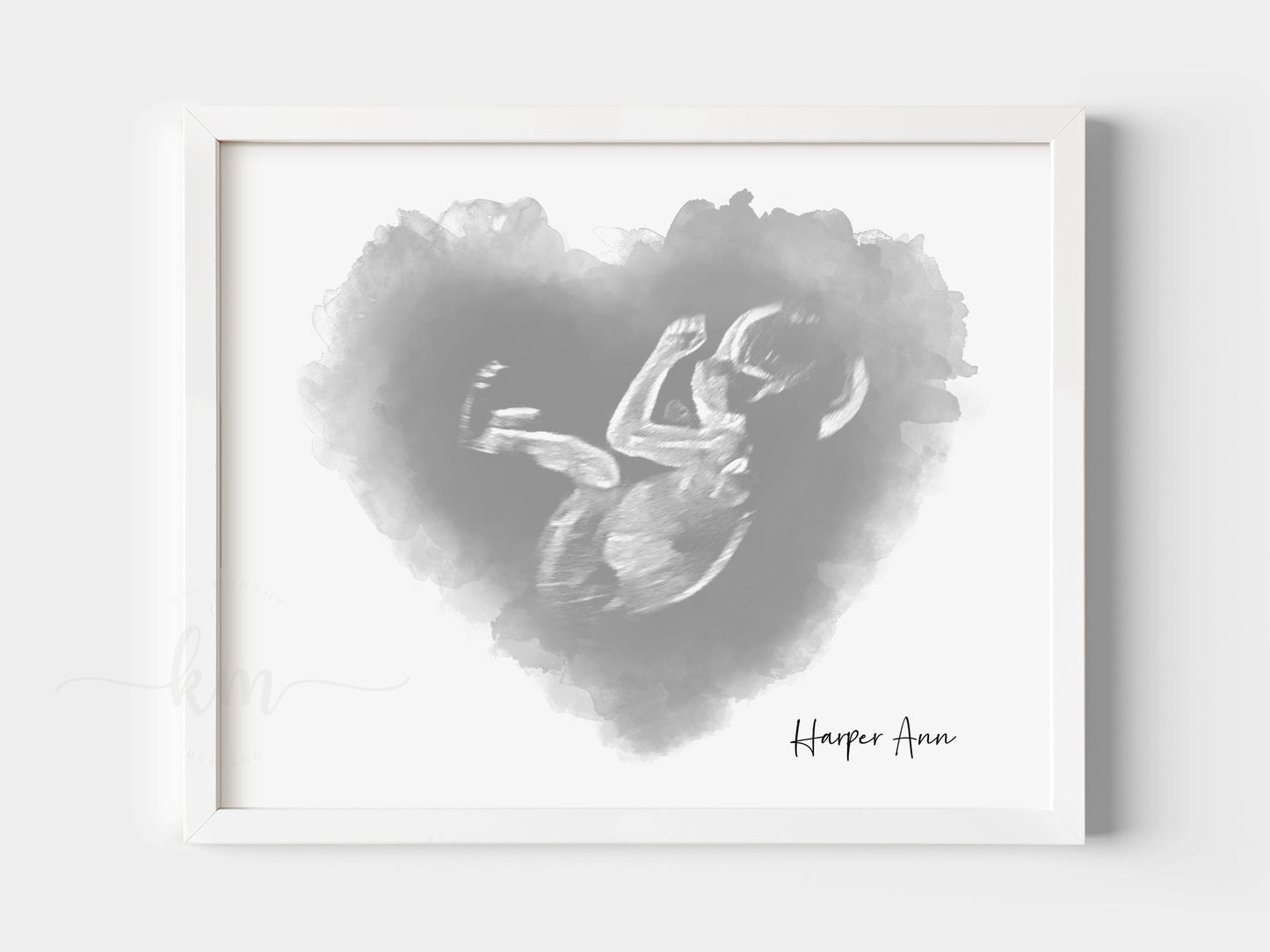 Heart Watercolor Ultrasound Art