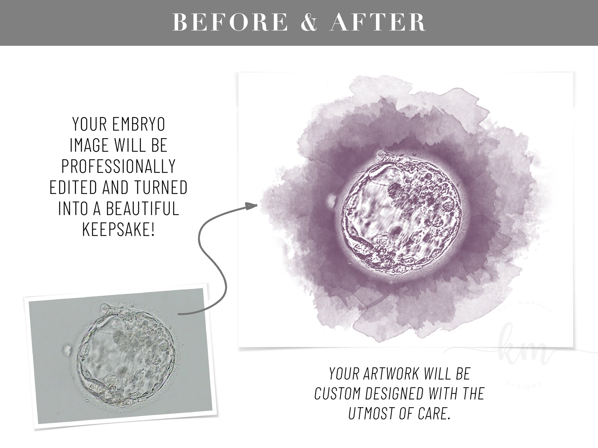 Custom watercolor embryo print for honoring pregnancy loss

