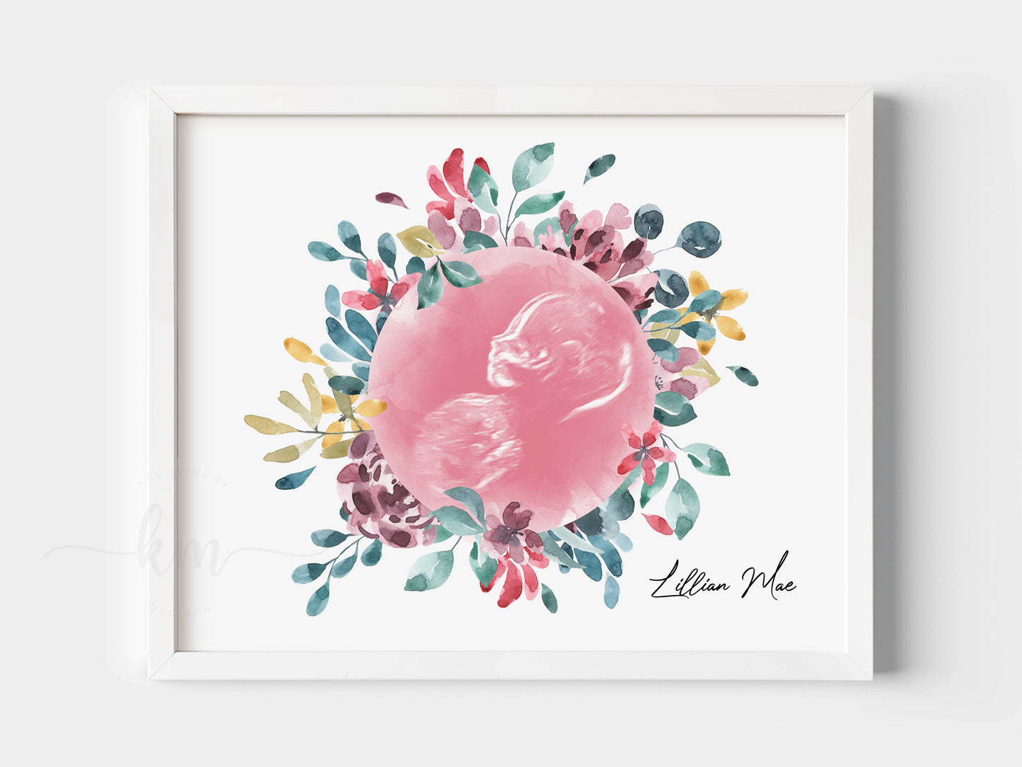Watercolor ultrasound art with flower wreath for miscarriage or baby loss gift

