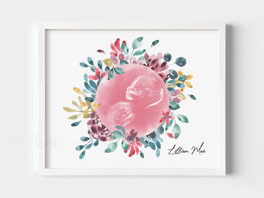 Watercolor ultrasound art with flower wreath for miscarriage or baby loss gift

