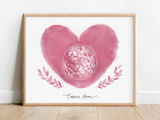 Heart with Branches Watercolor IVF Embryo Art