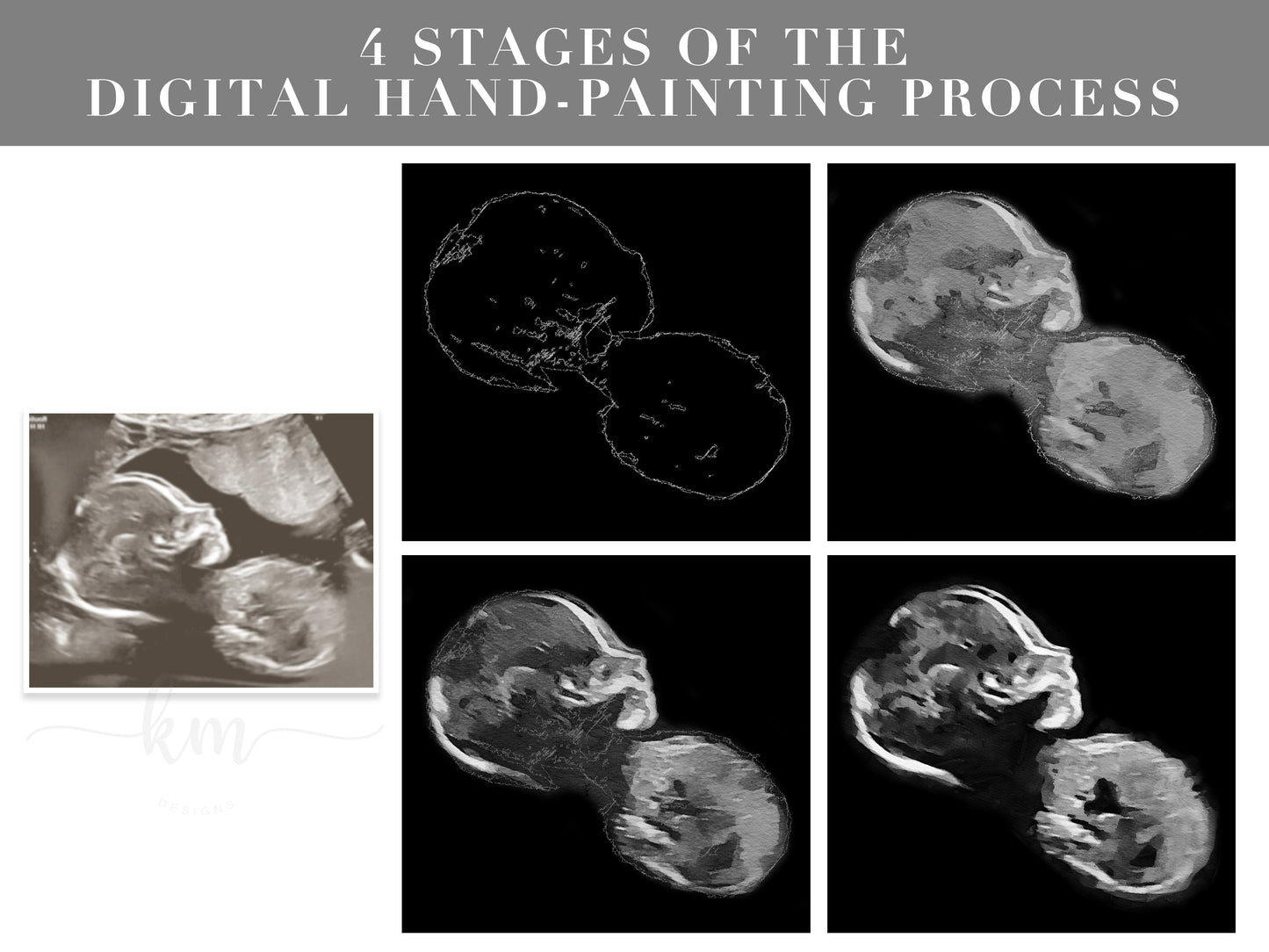 4 stages of the hand-painted watercolor process ultrasound art
