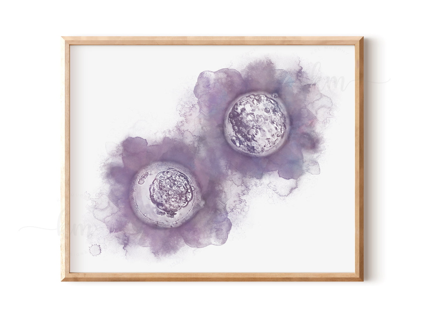 Hand-Painted Watercolor Twins IVF Embryo Art