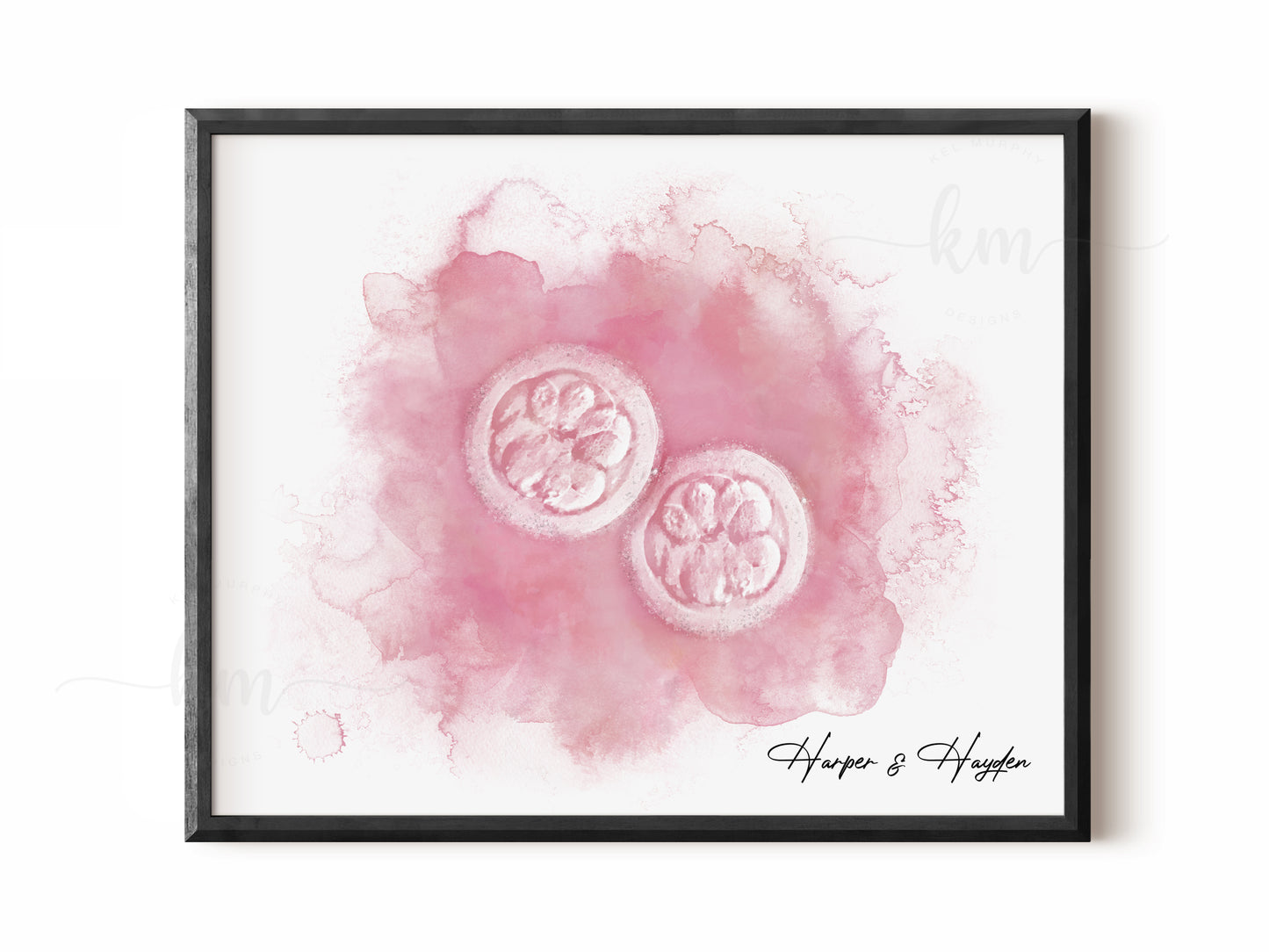 Hand-Painted Watercolor Twins IVF Embryo Art