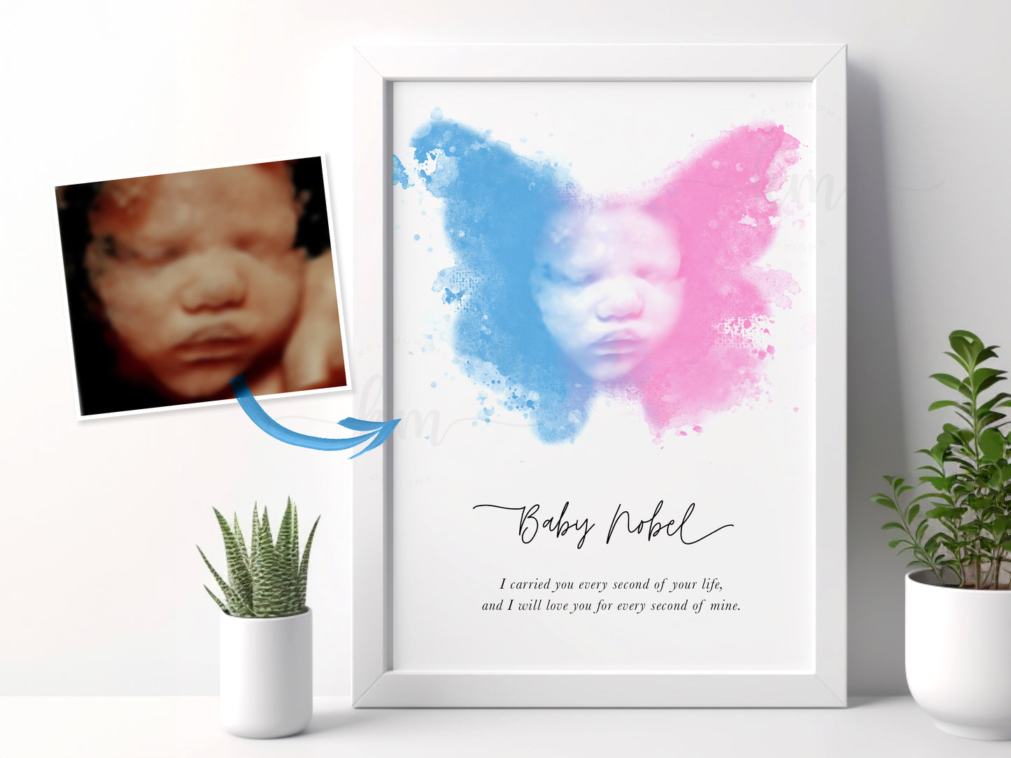 Baby memorial art featuring ultrasound and butterfly design

