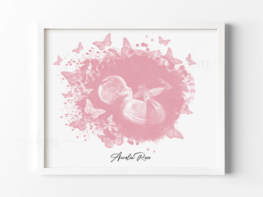 Personalized butterfly ultrasound memorial for pregnancy or infant loss

