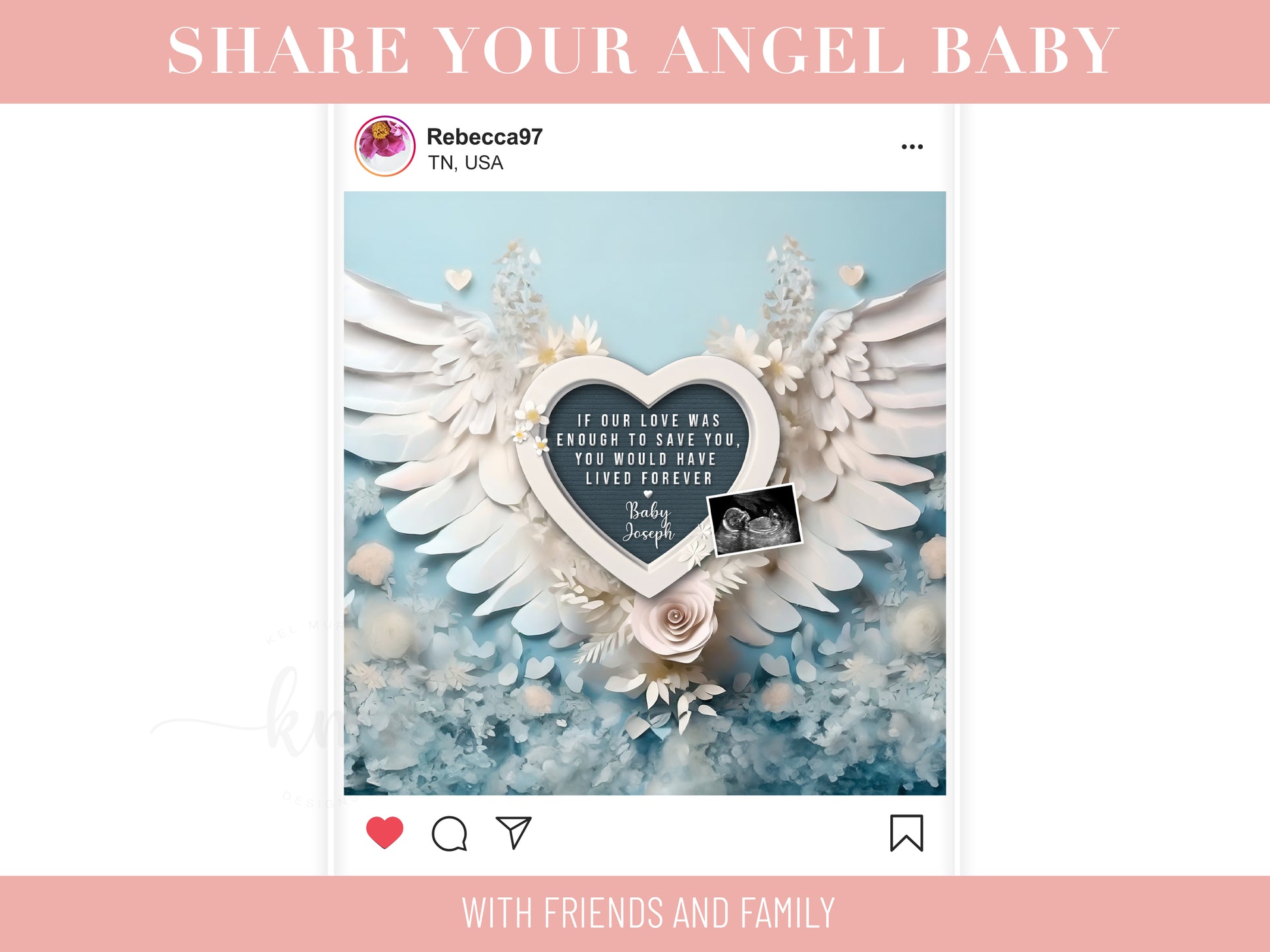 Personalized baby loss announcement featuring ultrasound and custom wording for remembrance

