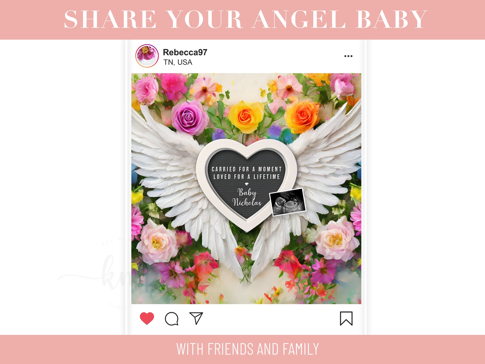 Personalized baby loss announcement featuring ultrasound and custom wording for remembrance

