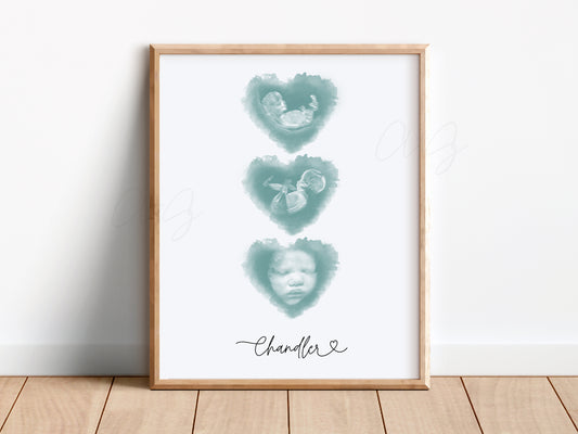 Three Hearts Watercolor Ultrasound Art - Vertical
