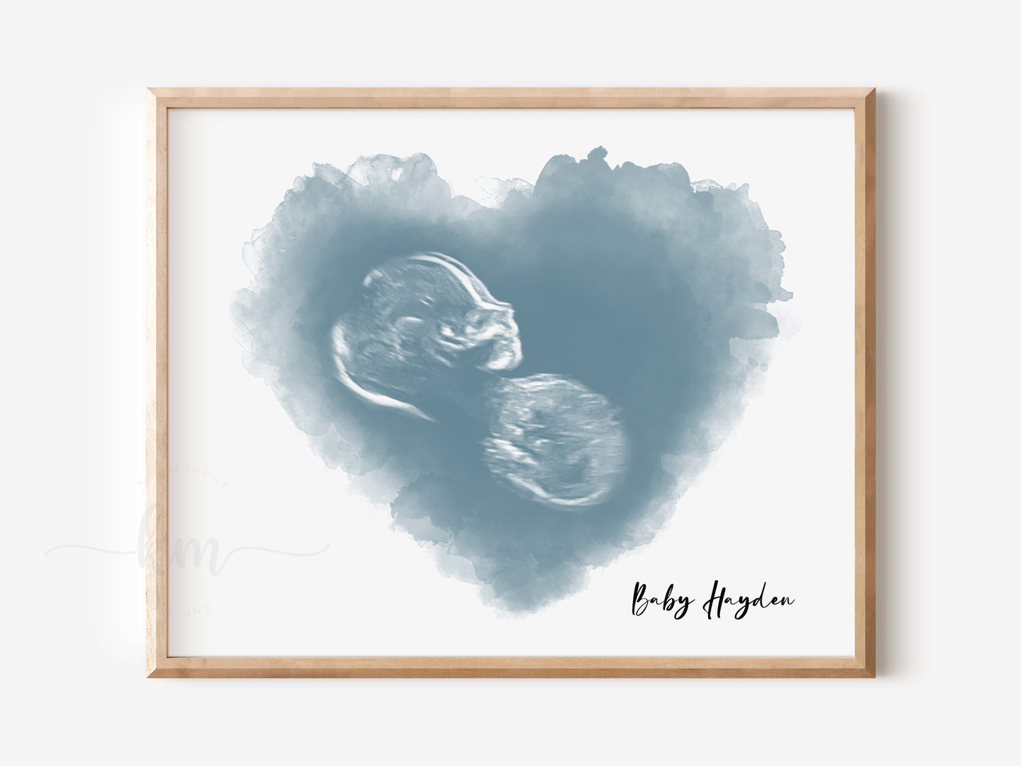 Heart Watercolor Ultrasound Art