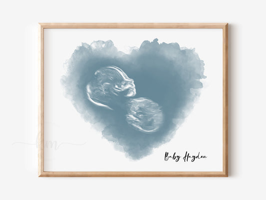 Heart Watercolor Ultrasound Art
