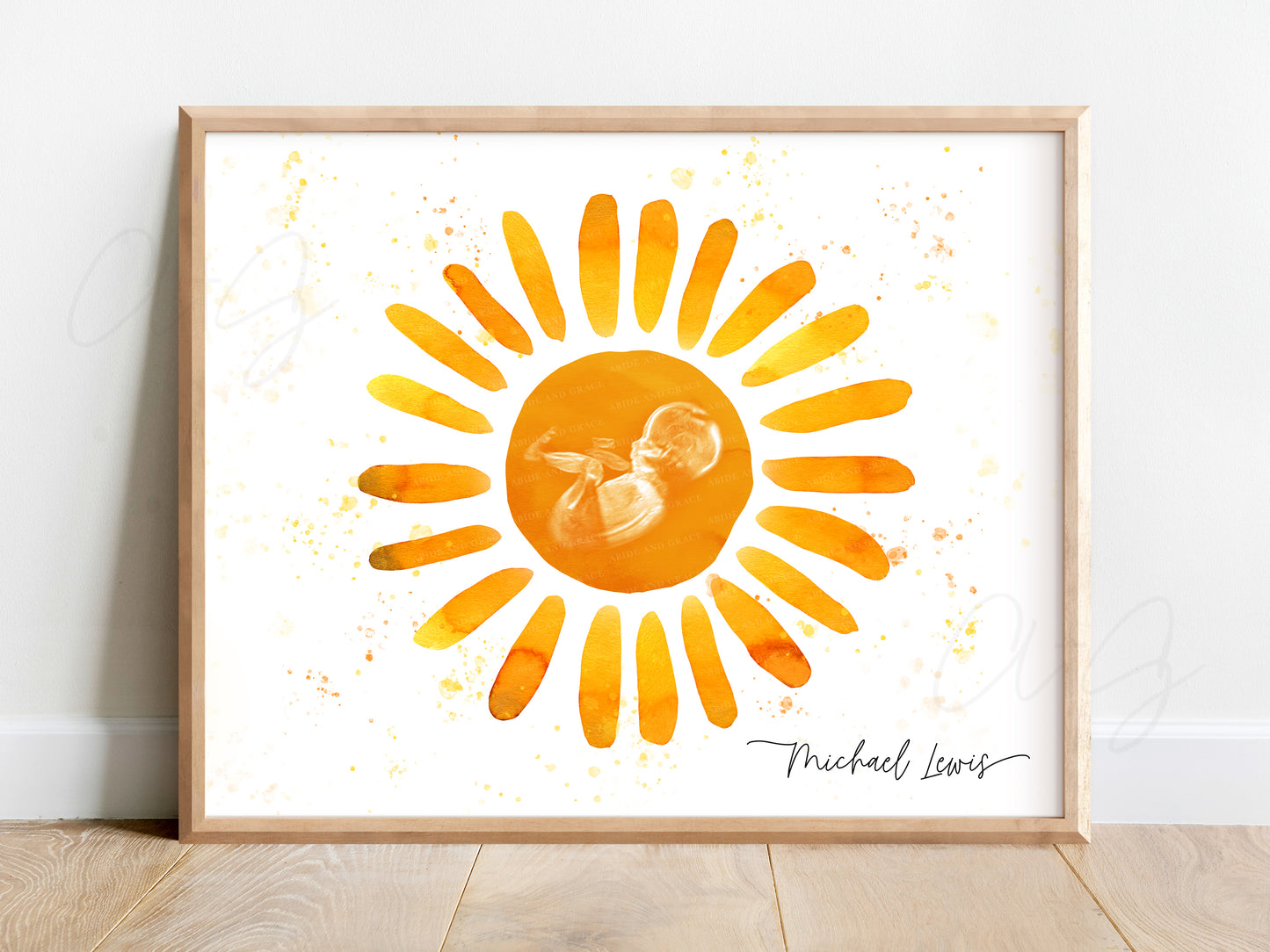 Sun Watercolor Ultrasound Art