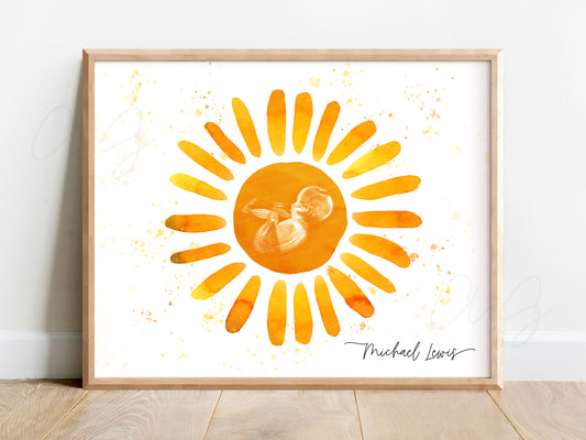 Sun Watercolor Ultrasound Art