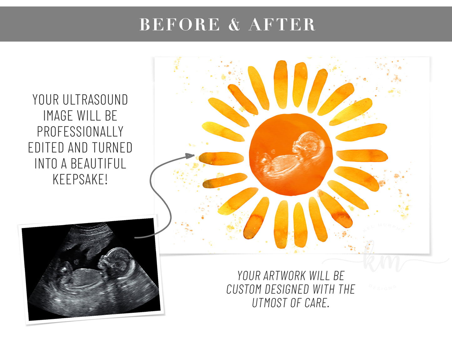 Before and after of ultrasound image and painted sunshine design – meaningful tribute

