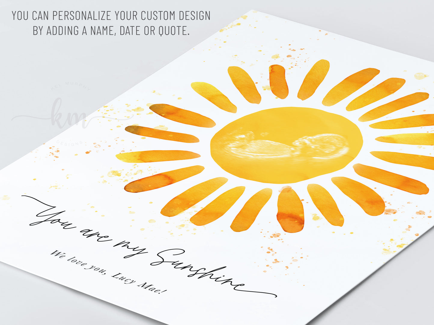Ultrasound keepsake art with sunshine theme – personalized with name or verse

