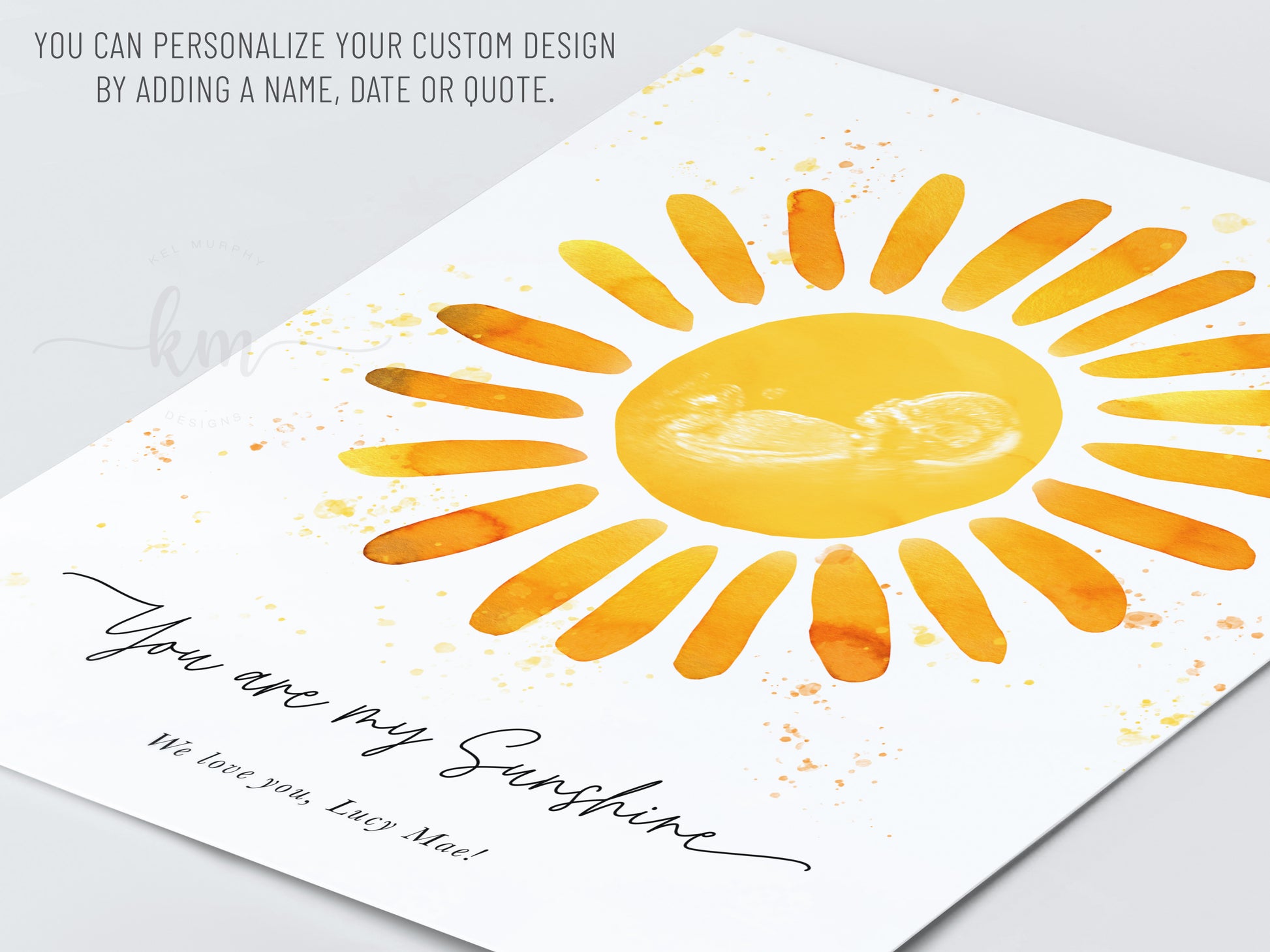 Ultrasound keepsake art with sunshine theme – personalized with name or verse

