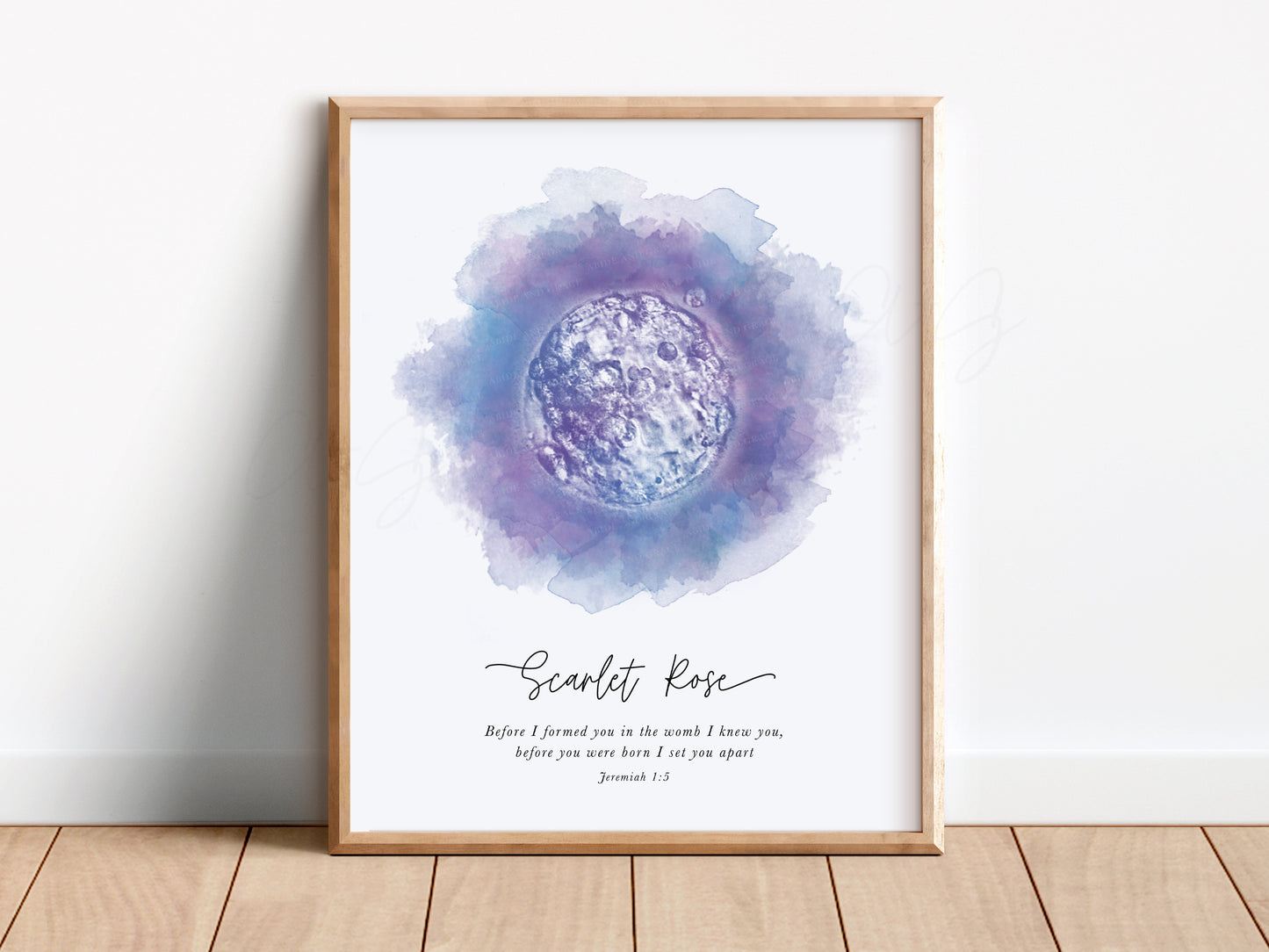 Circle Watercolor IVF Embryo Art