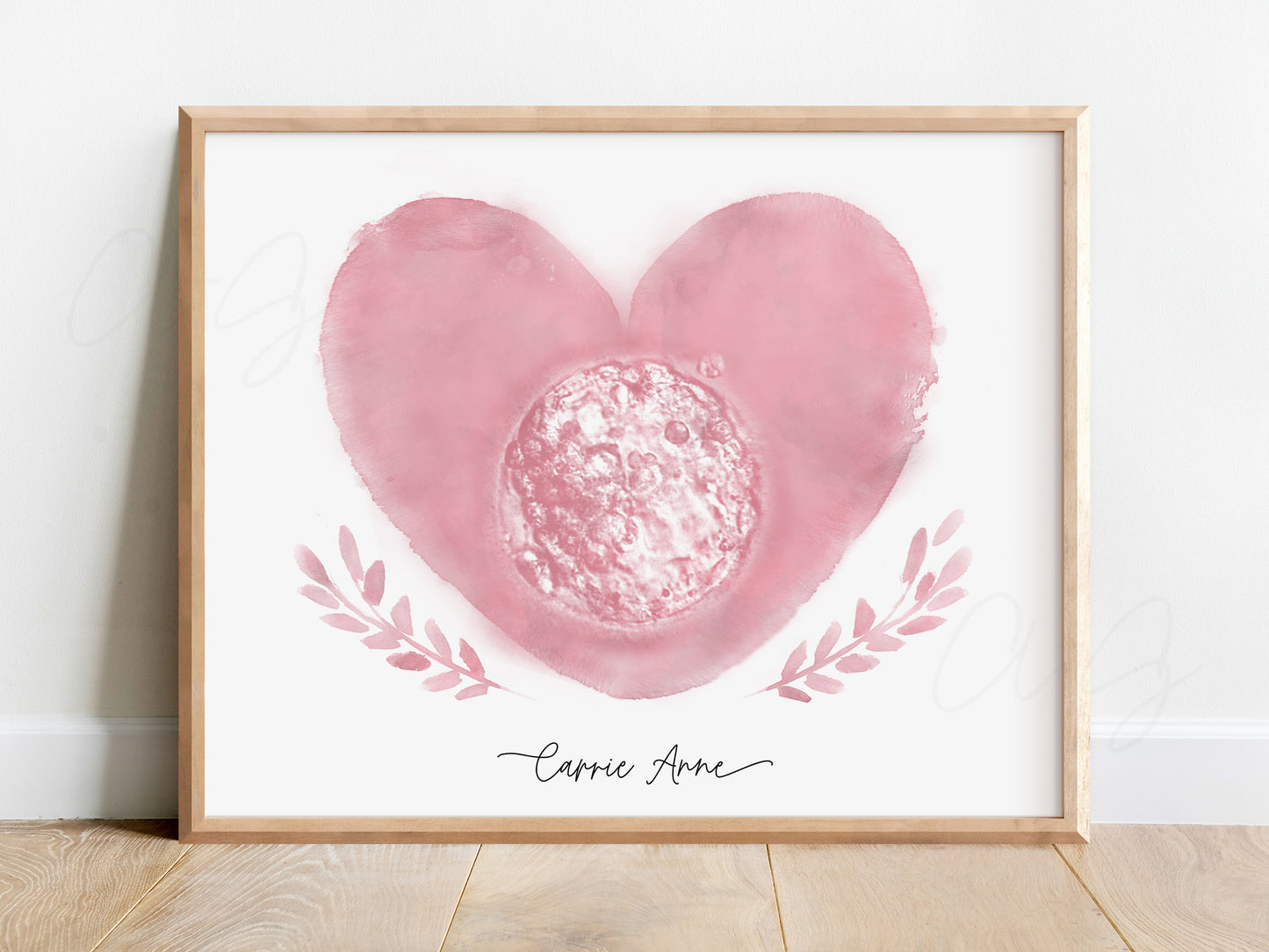 Heart with Branches Watercolor IVF Embryo Art