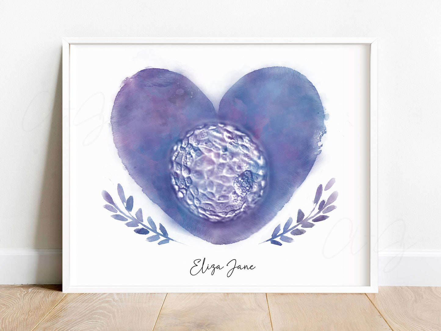 Heart with Branches Watercolor IVF Embryo Art
