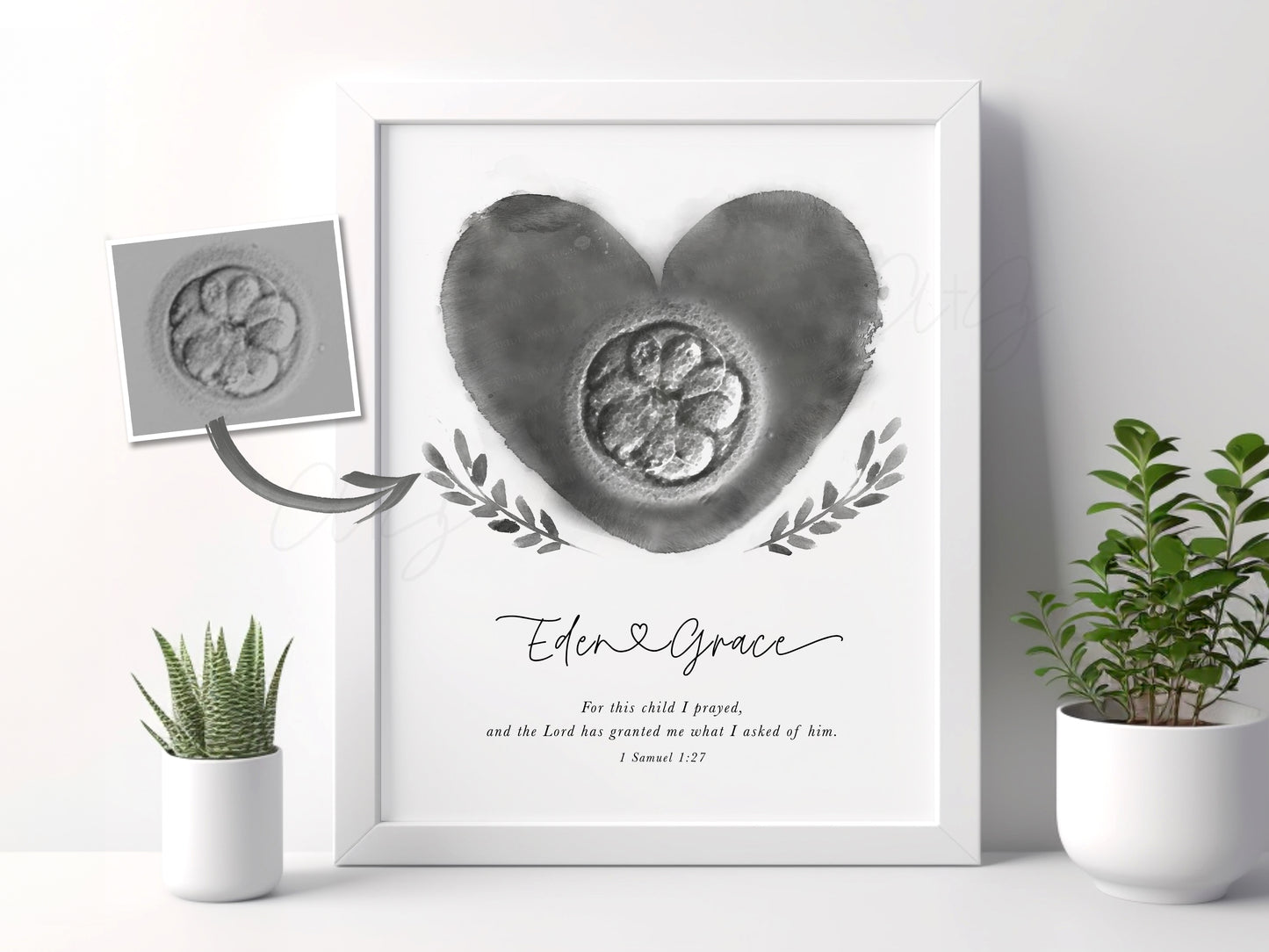 Heart with Branches Watercolor IVF Embryo Art