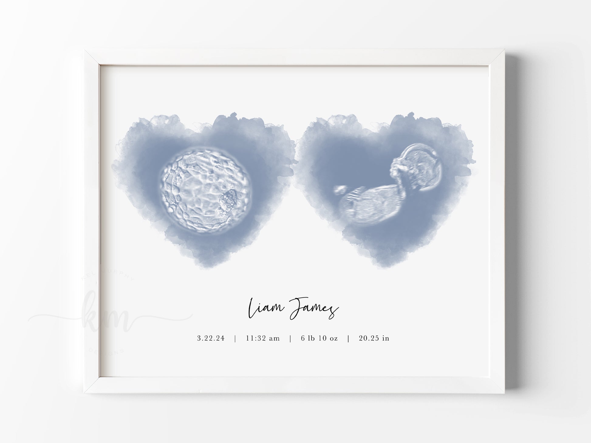 Personalized IVF embryo and ultrasound keepsake for baby shower or memorial

