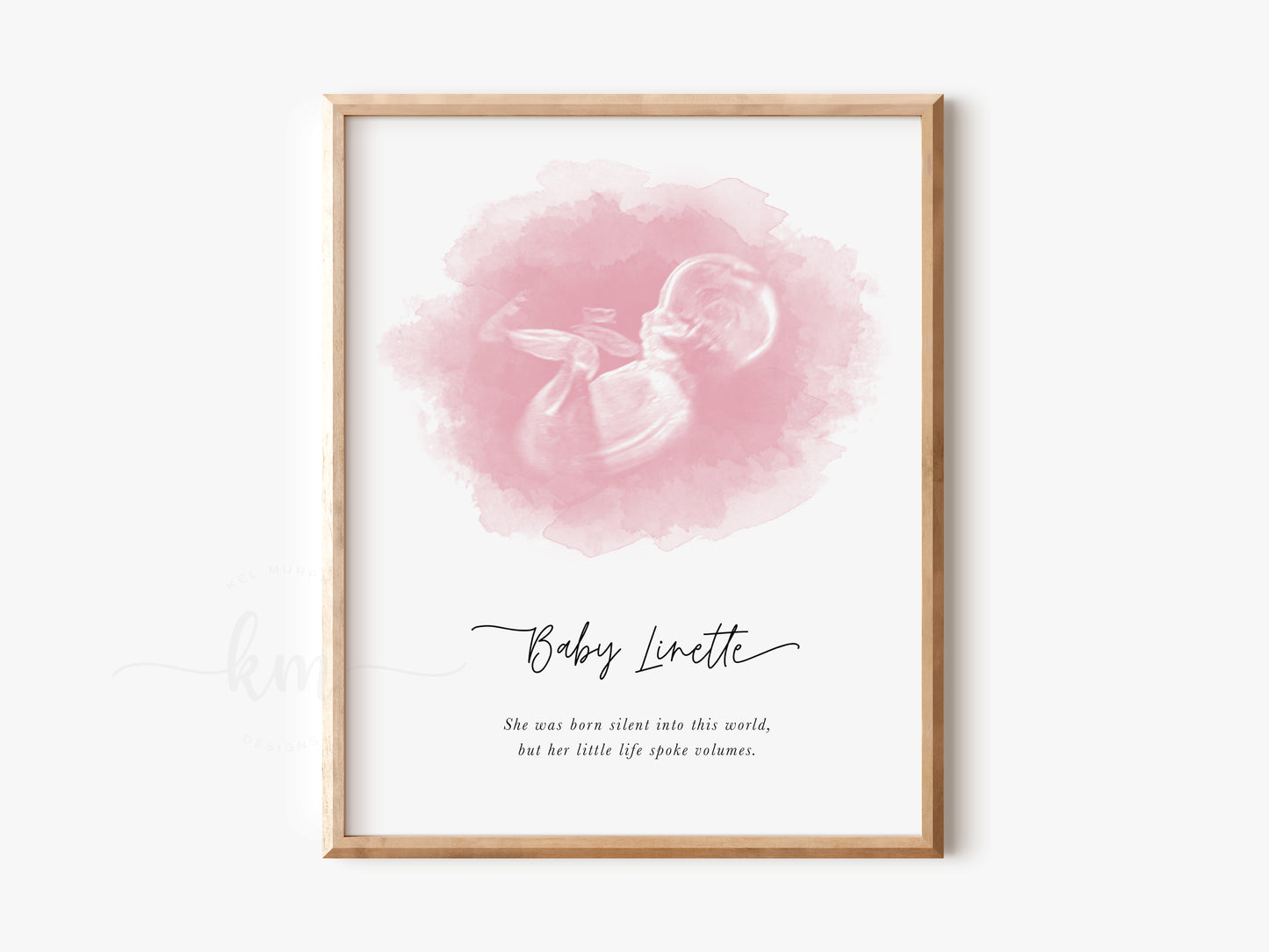Oval watercolor ultrasound art for baby loss memorial gift

