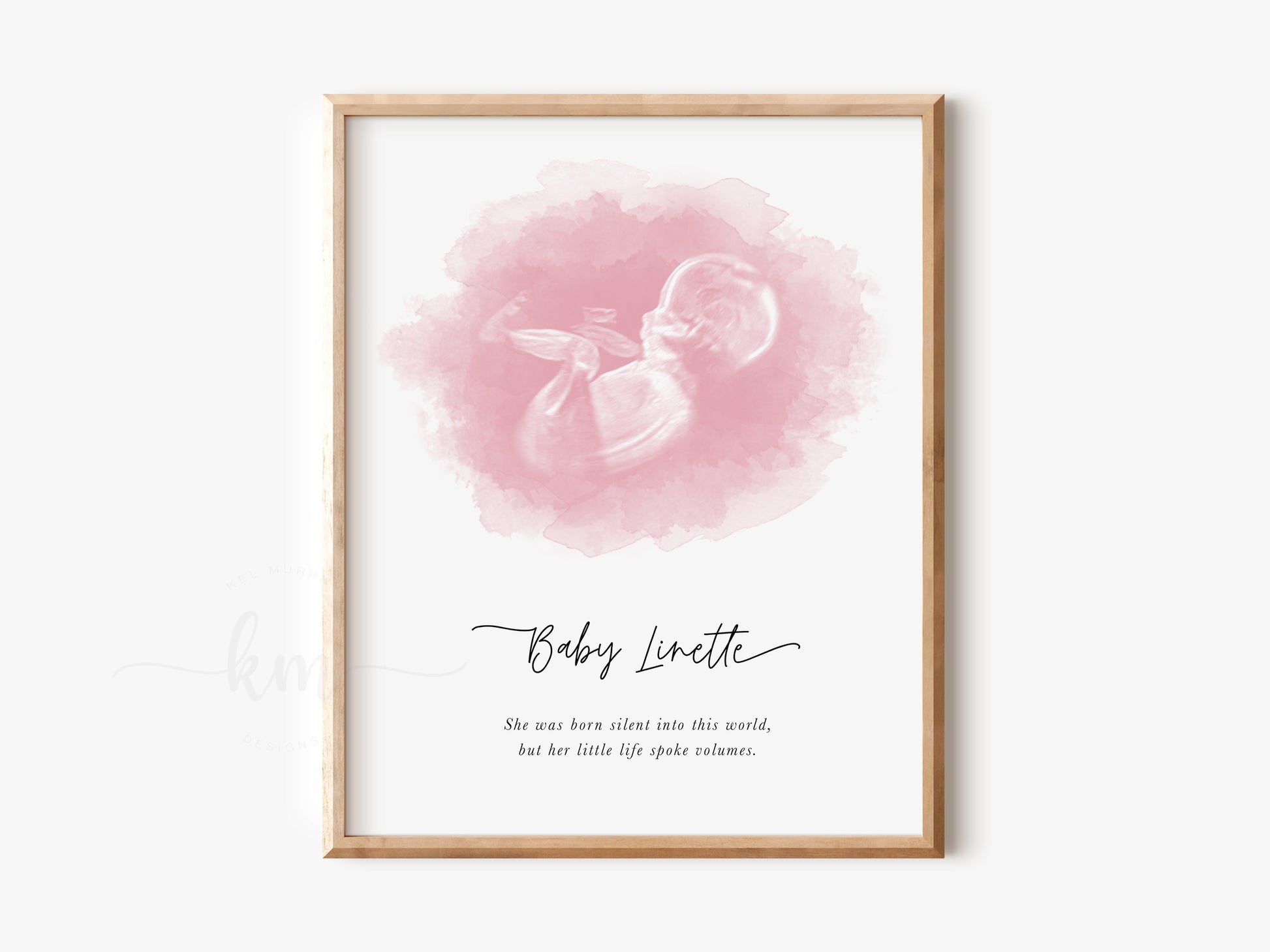 Oval watercolor ultrasound art for baby loss memorial gift

