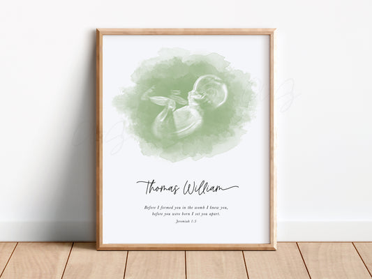 Oval Watercolor Ultrasound Art (Vertical)