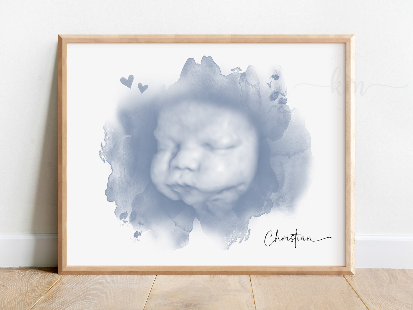 Cloud and Hearts Watercolor Ultrasound Art