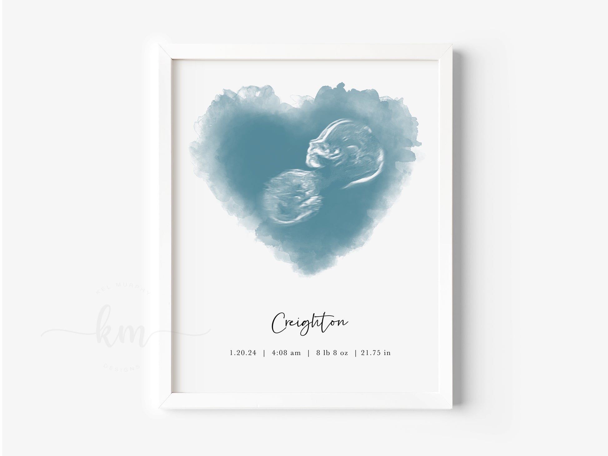 Personalized ultrasound art with heart design for baby shower gift

