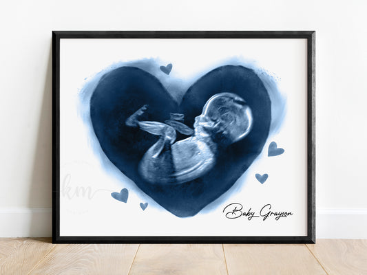 Hearts ultrasound art for miscarriage or baby loss memorial

