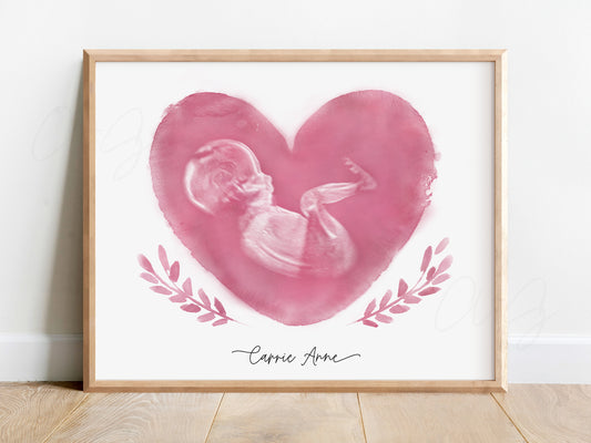 Heart with Branches Watercolor Ultrasound Art