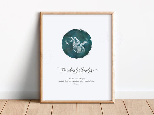 Modern Circle Watercolor Ultrasound Art