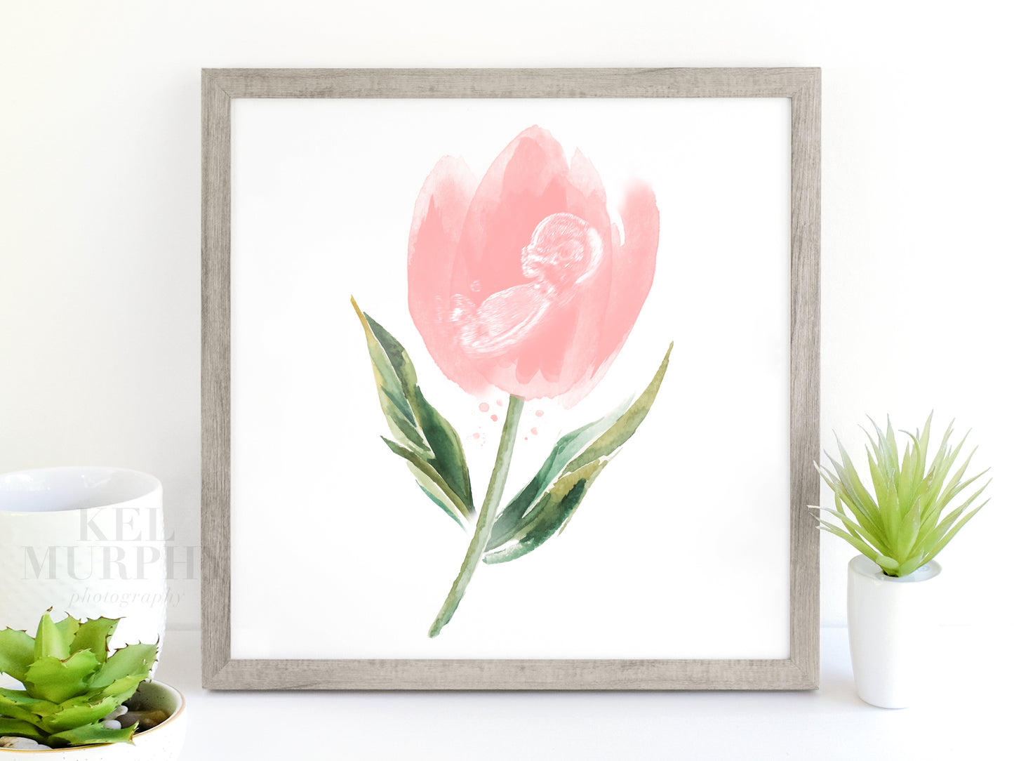 Custom ultrasound artwork with tulip watercolor design

