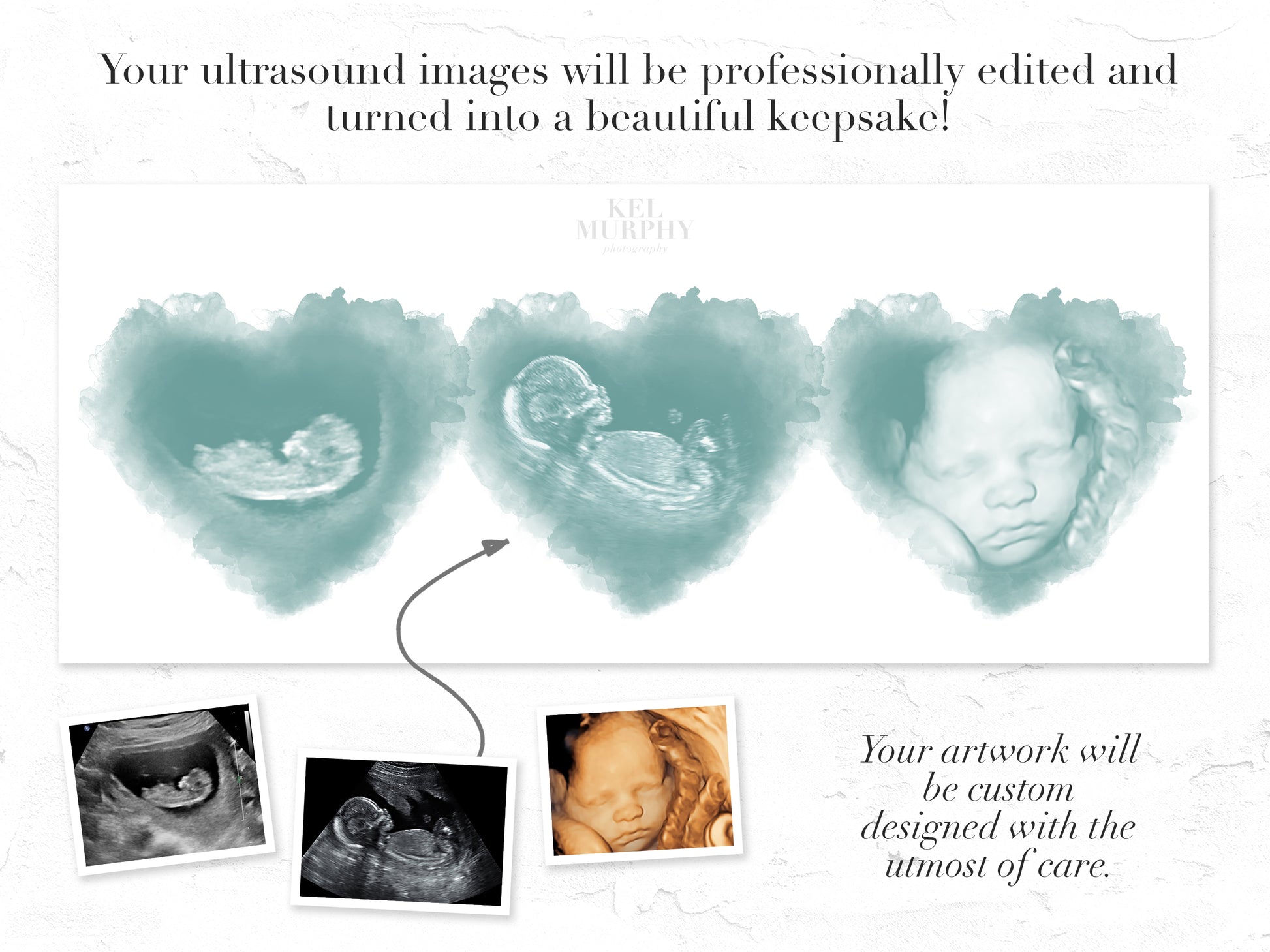 Custom three-heart ultrasound art for miscarriage or new mom gift

